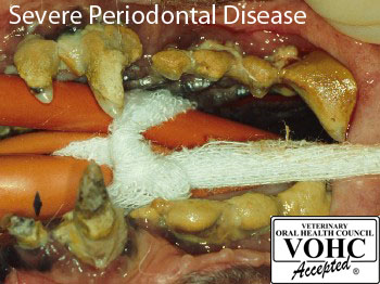 Severe_perio350pixJPG dental